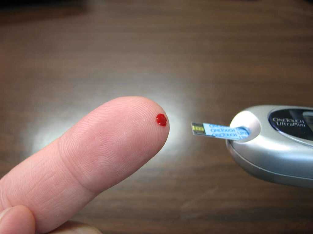 Blutzucker Blutzuckermessgerät Altenpflege Krankenpflege