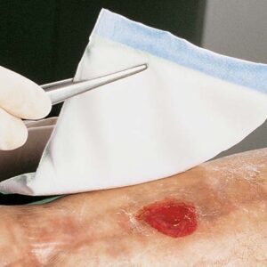 Lohmann Vliwazell Steril 10x10cm (P=25)